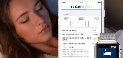 ResearchKitを使ったアップルウォッチ専用かゆみアプリ ‘Itch Tracker’の公開