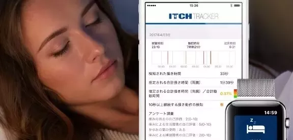 ResearchKitを使ったアップルウォッチ専用かゆみアプリ ‘Itch Tracker’の公開